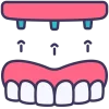dental-implant (1) dental-implant (1)